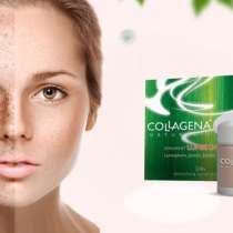 Надоели веснушки?, в г.Мадрид